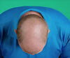 Hair Grow Max 2x1 a 49,99€